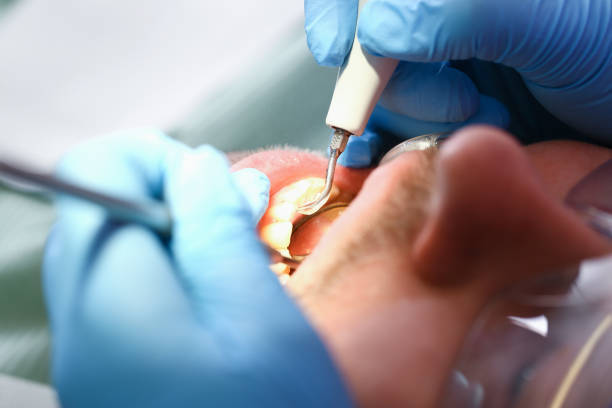 Best Emergency Denture Repair in La Center, WA