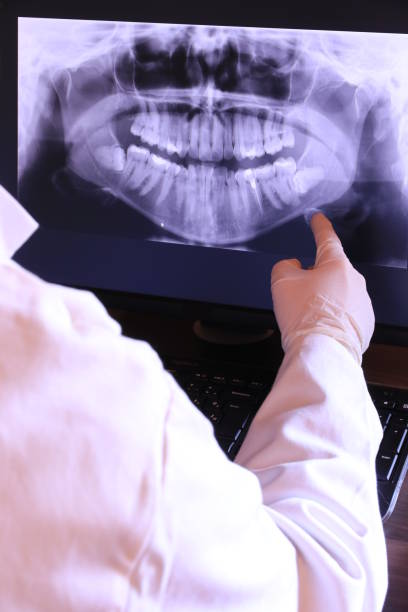 Best Emergency Dental Care for Broken or Chipped Teeth in La Center, WA